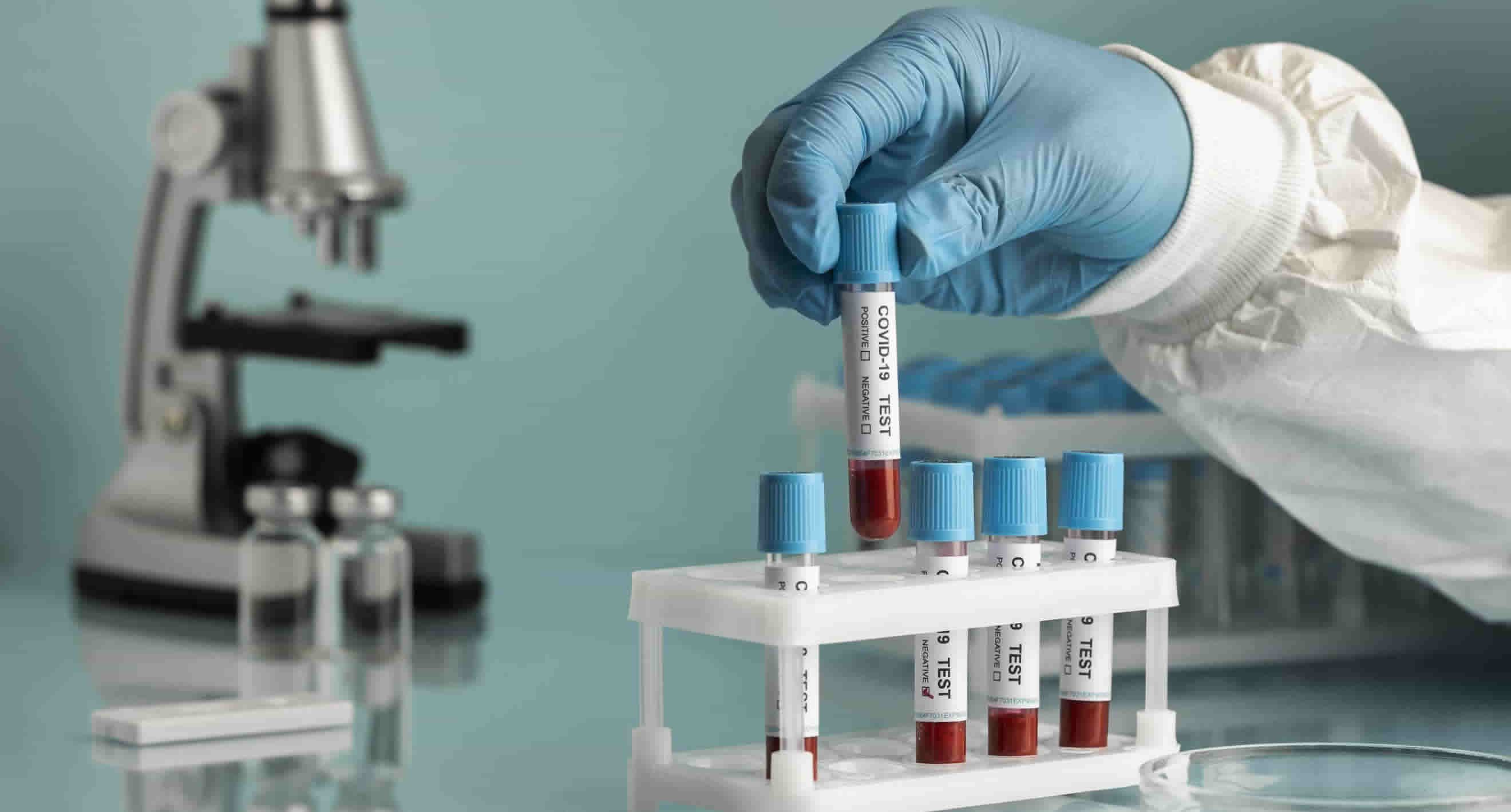 Mano con guantes protectores sosteniendo un tubo de ensayo para prueba de COVID-19 en un laboratorio